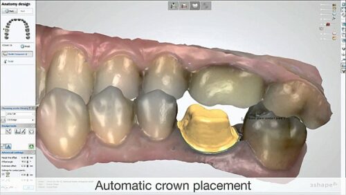 Dental Designer
